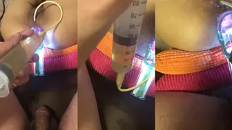 尿道注射 菊花扩尿尿