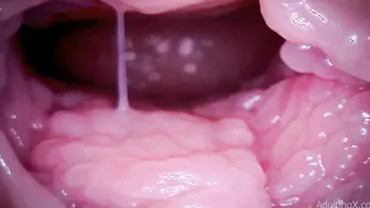 欧美内窥镜 观察逼洞里面的构造还有它的活动状态