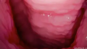 欧美内窥镜 观察逼洞里面的构造还有它的活动状态