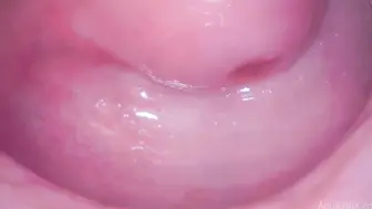 欧美内窥镜 观察逼洞里面的构造还有它的活动状态