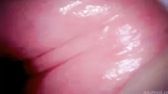 欧美内窥镜 观察逼洞里面的构造还有它的活动状态