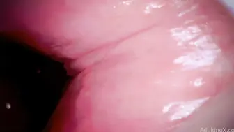 欧美内窥镜 观察逼洞里面的构造还有它的活动状态