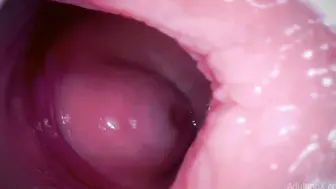 欧美内窥镜 观察逼洞里面的构造还有它的活动状态